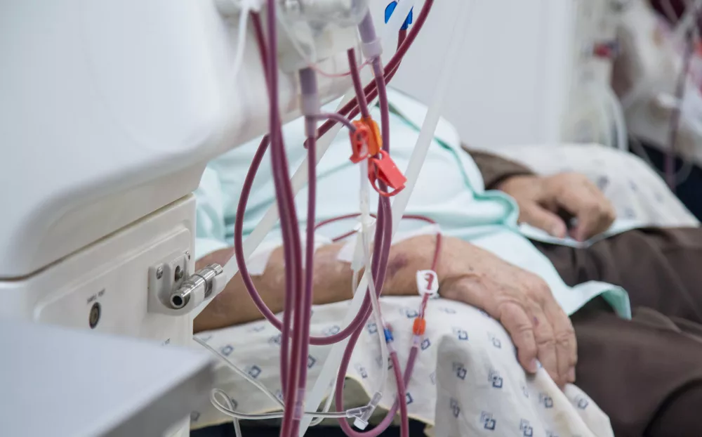 Hemodialysis